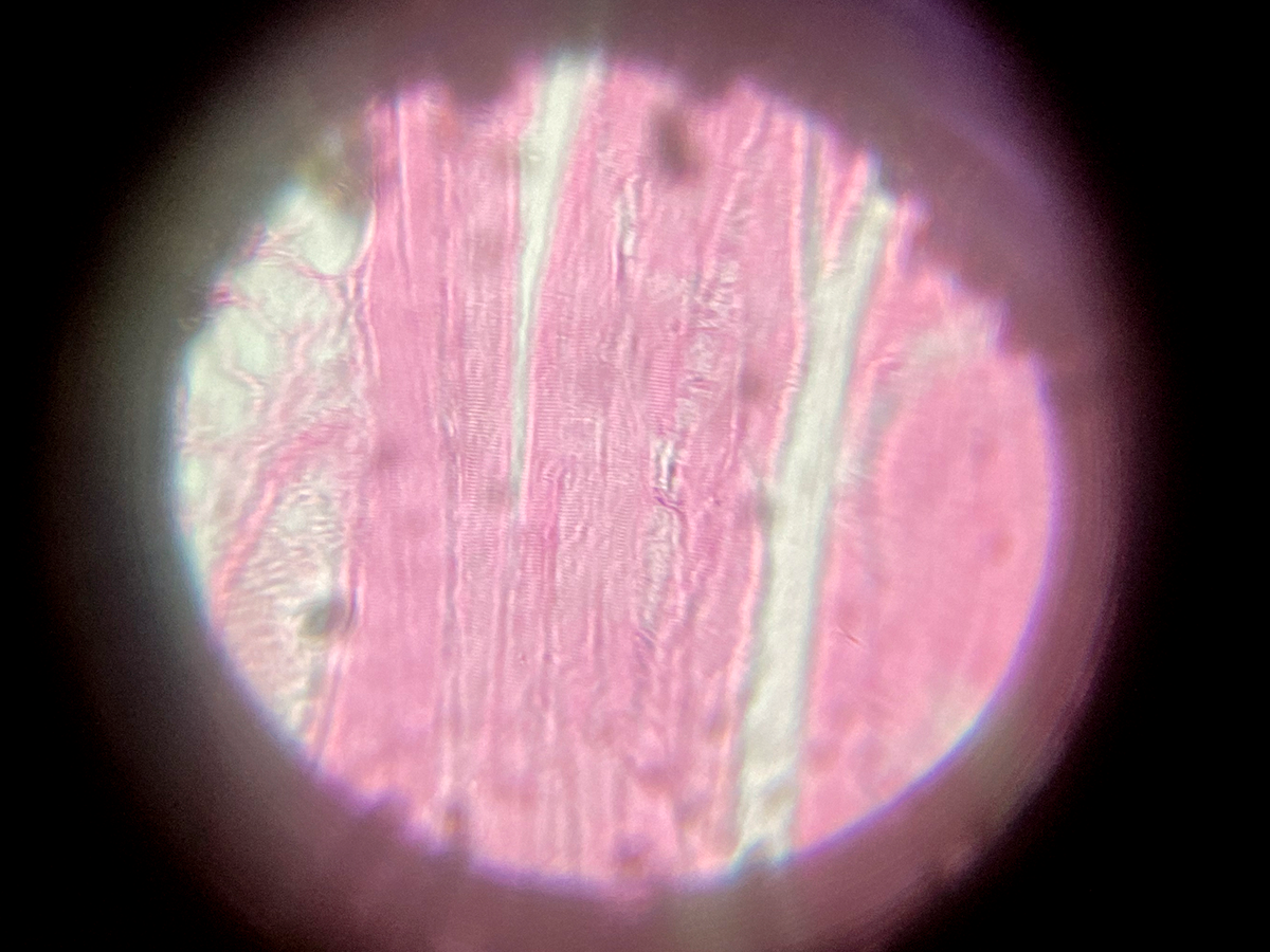 Human muscle seen on Modern slide preparation, seen through spehere Replica by WimvanEgmond.png